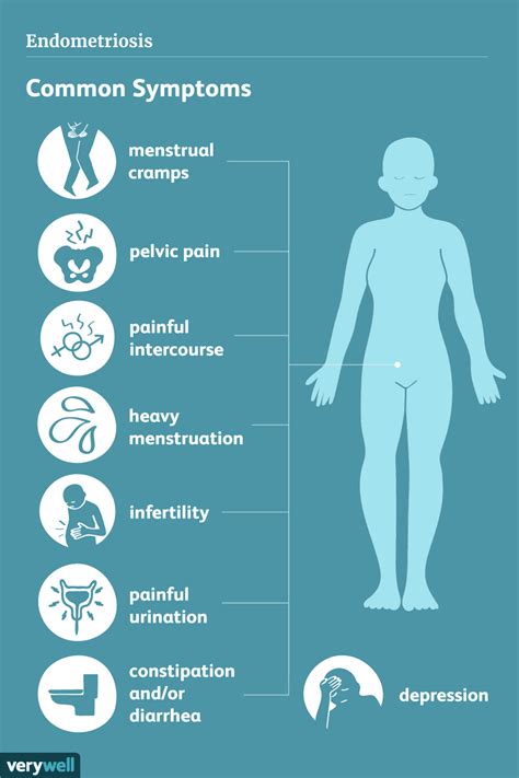 Symptoms of Endometriosis