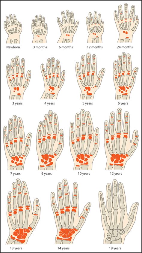 Bone Age Hand