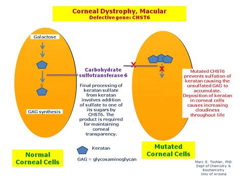 Corneal Dystrophy, Macular | Hereditary Ocular Diseases