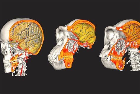 Human brain, braincase evolved independently, researchers say - UPI.com