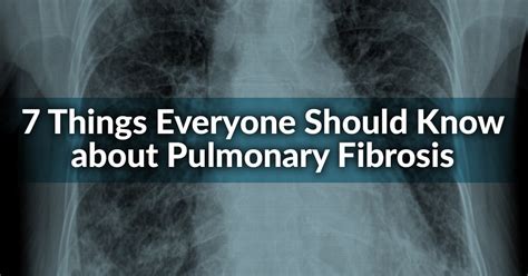 7 Things Everyone Should Know about Pulmonary Fibrosis | American Lung ...