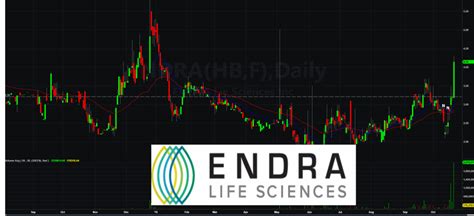 מניית ENDRA LIFE SCIENCES סימבול (NDRA) - רז גמליאל