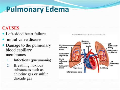 PPT - Chapter: 38 Pulmonary Circulation, Pulmonary Edema, Pleural Fluid ...