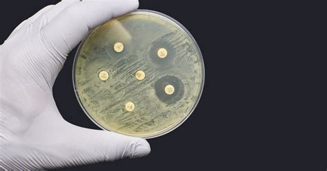 Antimicrobial resistance – the slow pandemic