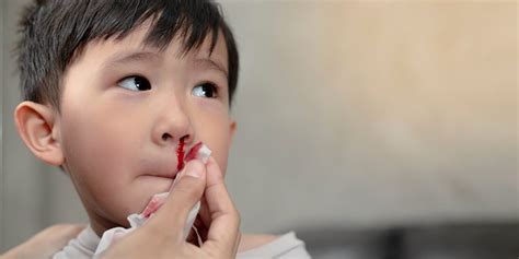 Bleeding from the nose in a child – what could it be? – Healthy Food ...