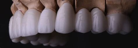 Advantages and Disadvantages of Zirconium Crowns, Types and Comparison