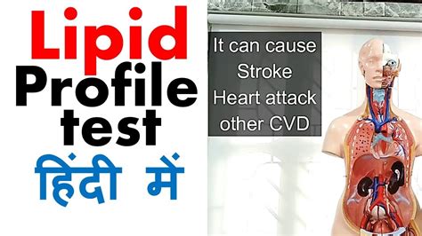 Lipid profile test in Hindi - YouTube