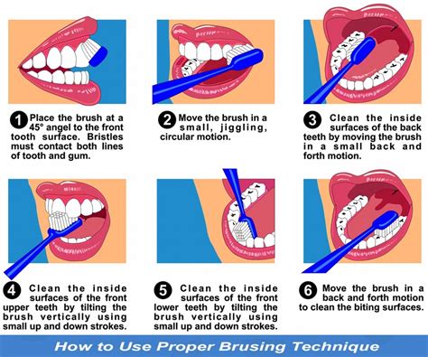 7 Bad Brushing Habits to Break - Hibiscus Dental