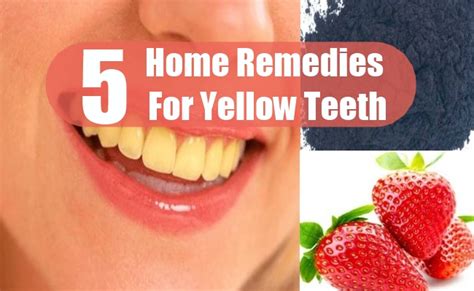 Top 5 Home Remedies For Yellow Teeth - Natural Ways To Treat Yellow ...