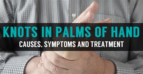 Knots and Lump in Palm of Hands | Symptoms & Home Treatment