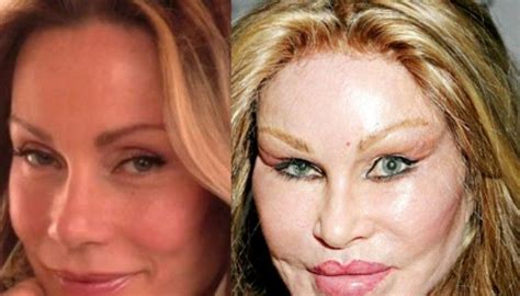 Complete Report On Jocelyn Wildenstein's Plastic Surgery: Know It All ...