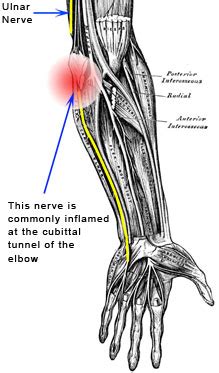 What causes the 'funny bone' pain sensation? : r/askscience