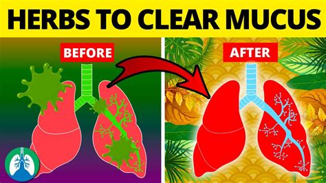 Gamer Depot: How To Loosen Mucus In Chest