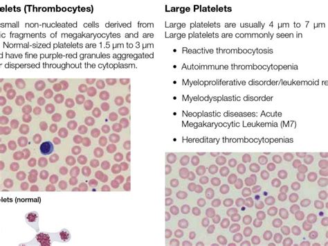 05 peripheral blood smear examination