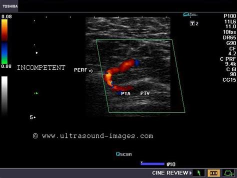 Ultrasound imaging: January 2012