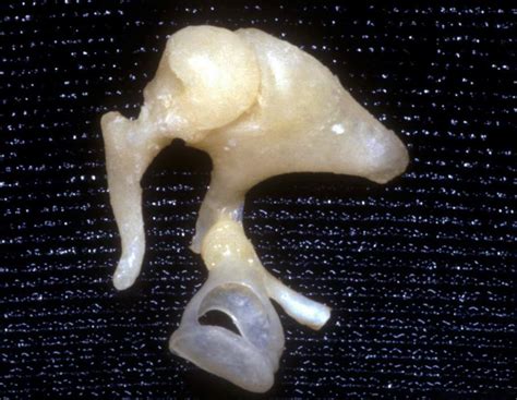 Middle Ear Bones | Neuroanatomy | The Neurosurgical Atlas