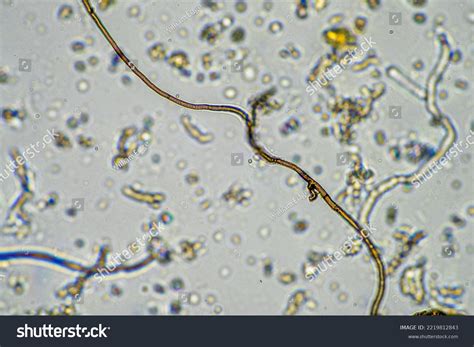 Soil Sample Under Microscope Soil Fungi Stock Photo 2219812843 ...