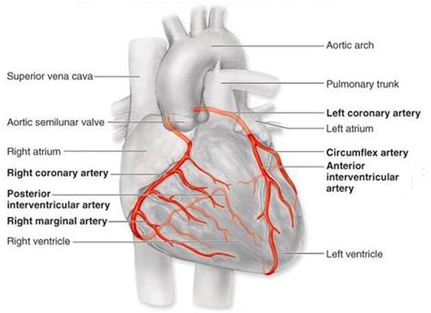 Pin on Cardiac Cath