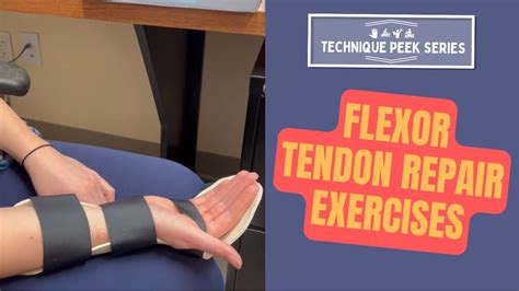 Flexor Tendon Repair: A Comparison of Two Protocols