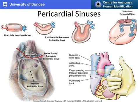 Pin by nonas arc on Pericardial Sinuses | Vena cava, Open heart surgery ...