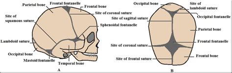 Newborns’ Cranial Vault: Clinical Anatomy and Authors’ Perspective ...