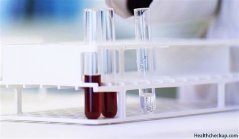 Electrolytes Blood Test - Results, Electrolytes Imbalance Causes,Symptoms