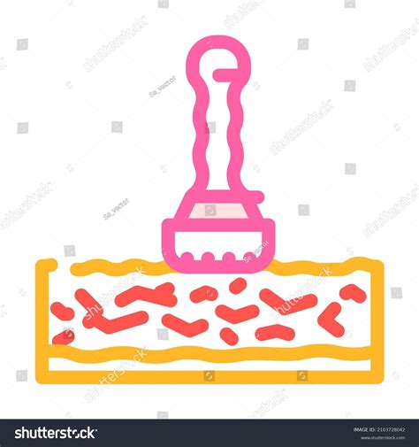 Laser Removal Blood Vessels Color Icon Stock Vector (Royalty Free ...