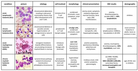 types of leukemia | Cancer | Pinterest