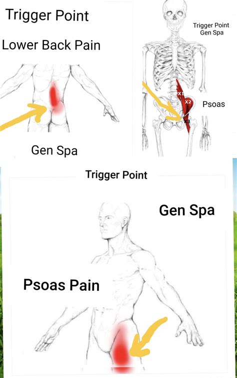 Psoas Muscle Pain Relief