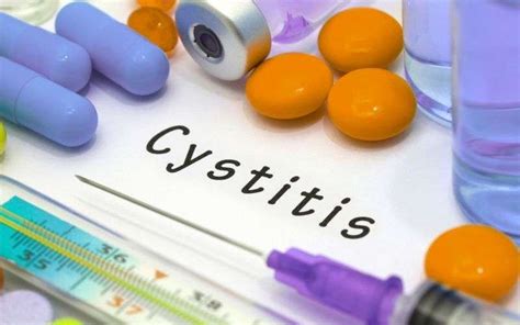 What is Interstitial Cystitis? Symptoms, Causes, and Treatment