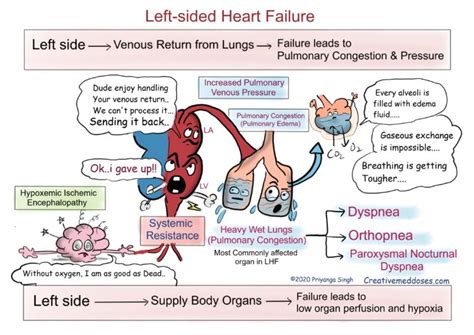 Heart Failure: Left sided VS Right sided - Creative Med Doses