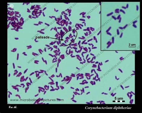 Corynebeacterium diphtheriae Microbiology Lab, Medical Laboratory ...