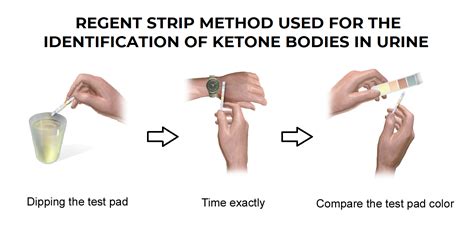 Ketonuria Test - Detection of ketone bodies in Urine