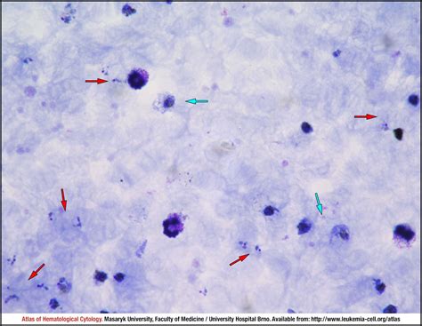 Plasmodium Vivax Images