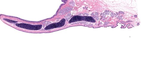 3: epiglottis histology Diagram | Quizlet