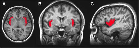 Insular Cortex Fmri