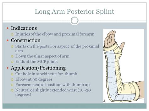 Long Arm Posterior Splint