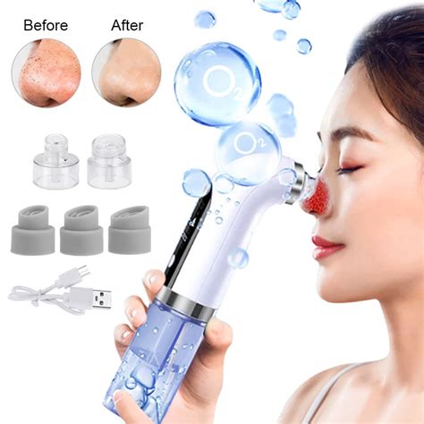 Rechargeable Blackhead Remover Acne Pimple Extractor Vacuum Facial Pore ...