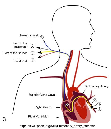 Pin on Medicine