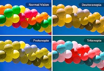 Color blindness (Types, Causes, Symptoms, Diagnosis, and Treatment ...