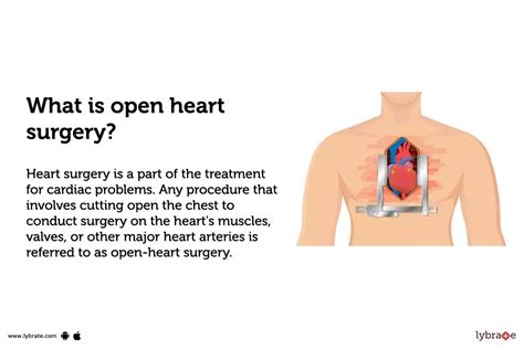 Open Heart Surgery: Purpose, Procedure, Benefits and Side Effects