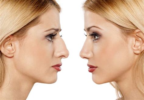 The Beauty of Balance - The Golden Ratio in Plastic Surgery | Edina ...