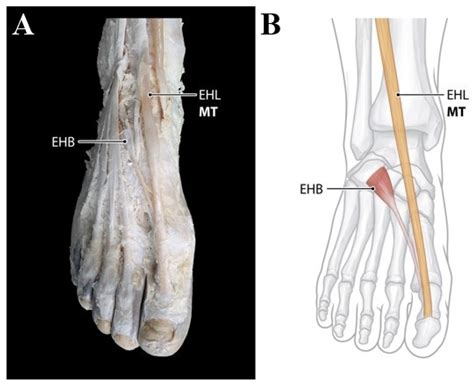 IJERPH | Free Full-Text | Anatomical Characteristics of Extensor ...