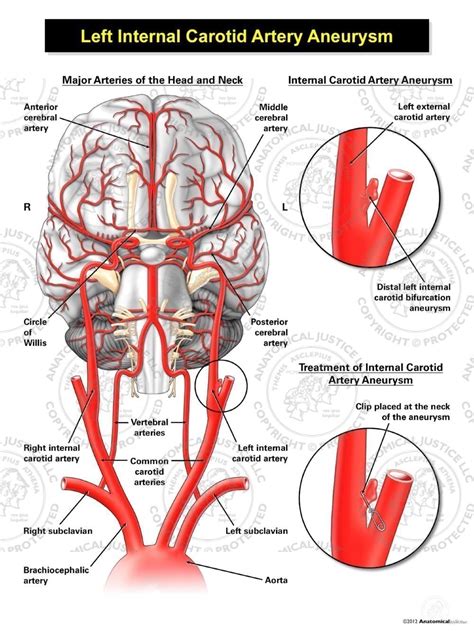 Branches Of Internal Carotid Artery Internal Carotid