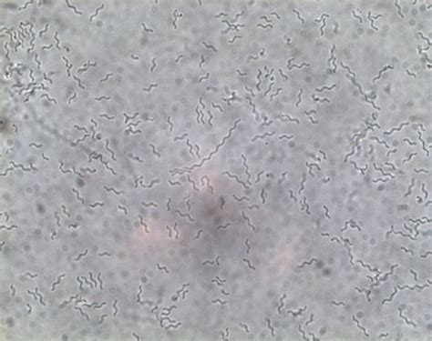 ESA - Bacteria through a microscope