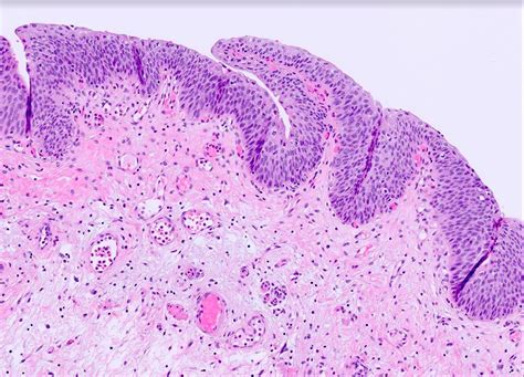 Pathology Outlines - Histology