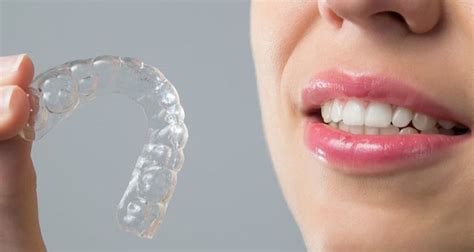 Best Home Teeth Aligners