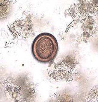 Echinococcus Granulosus Eggs, Wm Microscope Slide | ubicaciondepersonas ...