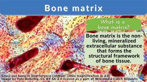 Bone matrix - Definition and Examples - Biology Online Dictionary