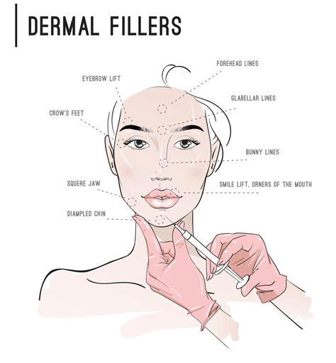 Temporary vs. Permanent Dermal Fillers, Types, Pros and Cons